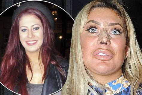 chloe ferry body|chloe ferry before and after.